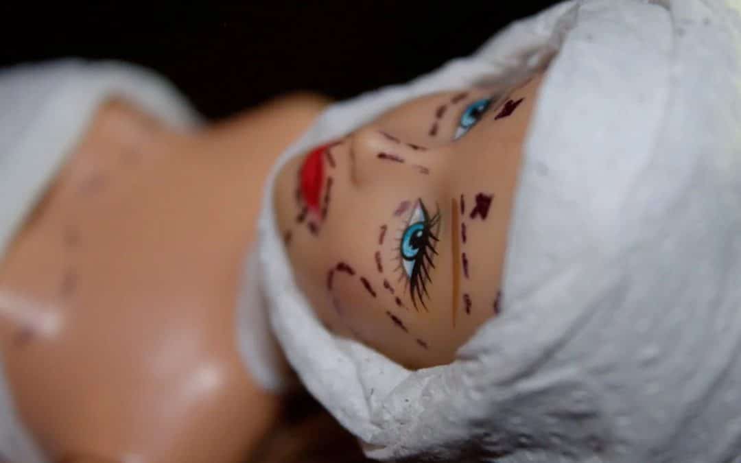 At what age can a facelift be considered?