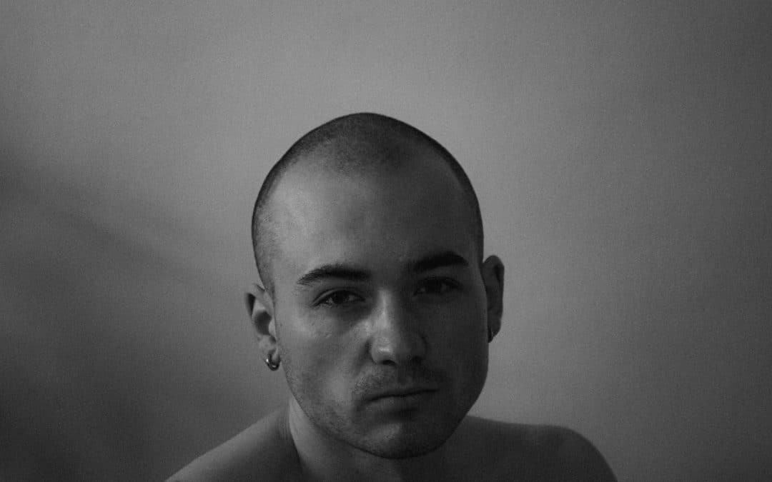 La greffe de cheveux est-elle douloureuse ?
